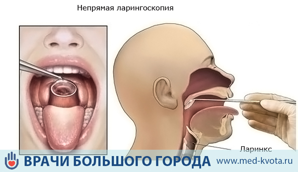 Диагностика рака голосовых связок