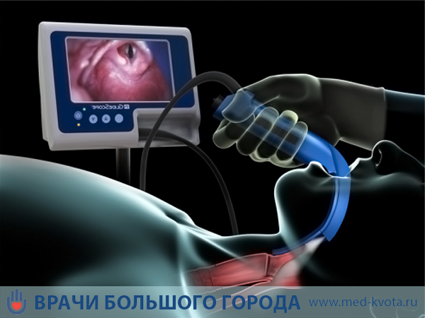 Лечение рака голосовых связок